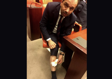 Eren Erdem AK Partili vekili bacağından ısırdı