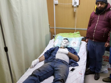 Termik santralde yangın: 3 yaralı