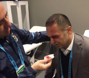 Hasan Çetinkaya'nın kafası yarıldı