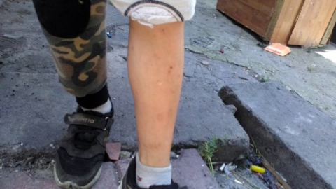 İstanbul'da inanılmaz olay: Mahalleyi pire bastı