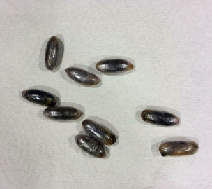 Bunlar hastanın değil bir suçlunun midesinden çıktı