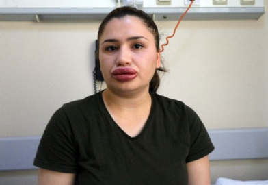 Estetik mağduru hemşireye kötü haber