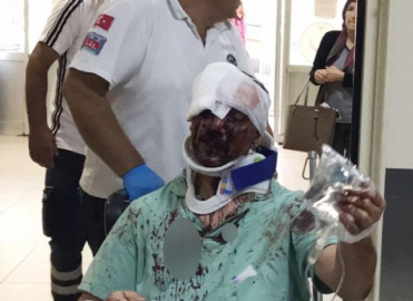 Ağabey-kardeş kavgasında 5 yaralı