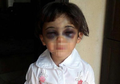 3 yaşındaki kızını döven üvey anne tutuklandı