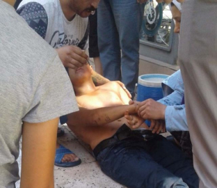 İş yerini temizlemek için tiner kullanan 2 kişi hastanelik oldu