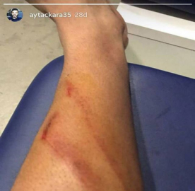 Aytaç Kara'dan maçın hakemine fotoğraflı tepki