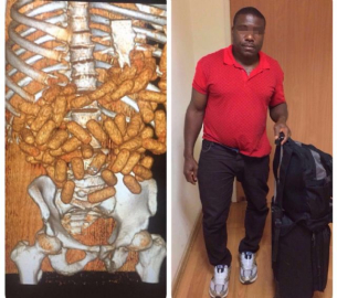 Midesinden 2 kilo uyuşturucu çıktı