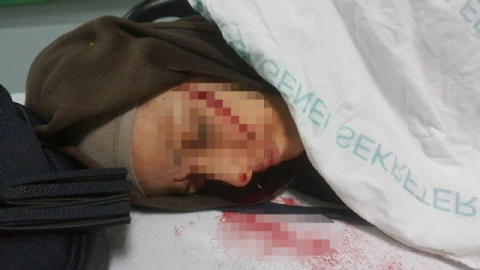 Eski koca dehşeti: 1'i ağır 2 yaralı