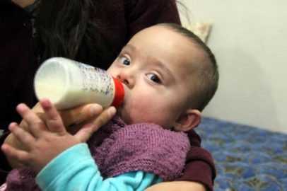 Eymen bebek yaşamak için yardım bekliyor