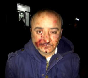 Yanlış anlaşılan öğretmen öldüresiye darp edildi