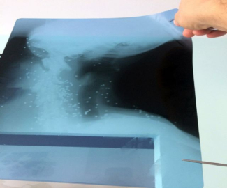 Yaralı köpeğin röntgen filmini görenler şok oldu