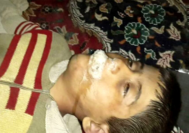 Katil Esed'den Doğu Guta'da kimyasal katliam: 75 ölü! Bilanço artıyor