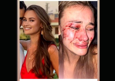 Ukraynalı top model Daria Kyryliuk Çeşme'de darbedildi