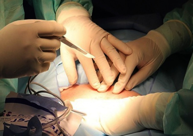 Beyin ölümü gerçekleşen hasta ameliyat sırasında uyandı