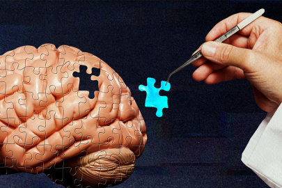 Kötü anıları silmek mümkün olacak mı? Yeni yöntem umut veriyor!