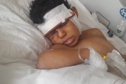 Sokak köpeği saldırısı: 5 yaşındaki çocuk yaralandı