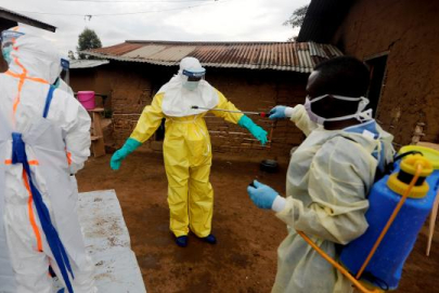 Tanzanya'da Marburg virüsü alarmı: Ölüm oranı yüzde 88