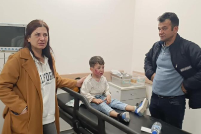 7 yaşındaki çocuk, oyun parkında başıboş köpeğin saldırısına uğradı