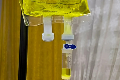 Sarı serum tedavisi hastalığı uzatıyor mu? İşte uzmanı tek tek açıkladı