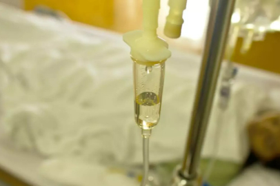 HÜRHABER Özel! Sarı Serum Tehlikesi: Evde Uygulamalar Sağlığı Riske Atıyor