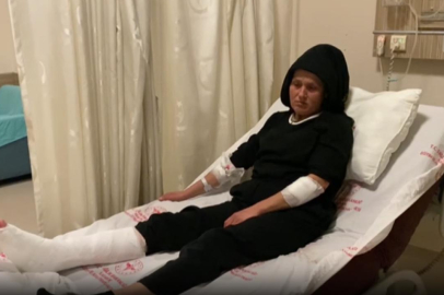 Sokakta yürüyen kadın 3 köpeğin saldırısına uğradı