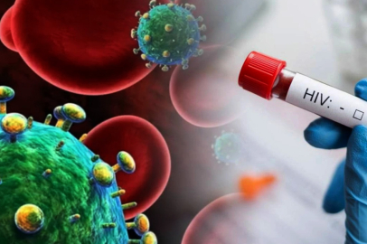 HIV tedavisinde tarihi adım: Virüs hücre içinde görünür hâle getirildi