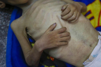 Yardım kuruluşları: Gazzeliler kitlesel açlık nedeniyle 'eriyor'