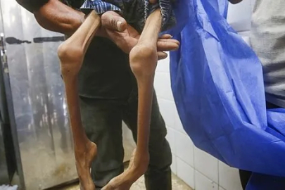 Gazze’de 2’si çocuk 6 kişi daha açlıktan öldü