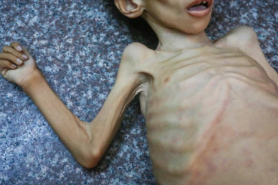 Gazze'de 147 kişi açlıktan öldü