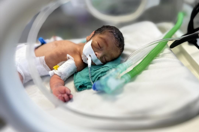 Gazze'de bebeği açlıktan hayatını kaybeden baba: Kızım açlıktan ağlıyordu ve ben çaresizdim