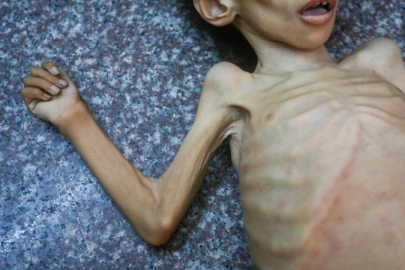 Soykırımcı İsrail televizyonunda, kızı açlıktan ölen Filistinli anne ile dalga geçildi