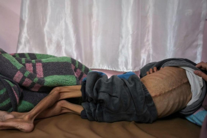 Gazze'de bir çocuk daha açlık nedeniyle hayatını kaybetti