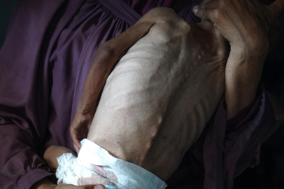 Gazze'de son 24 saatte 5 Filistinli daha açlıktan hayatını kaybetti