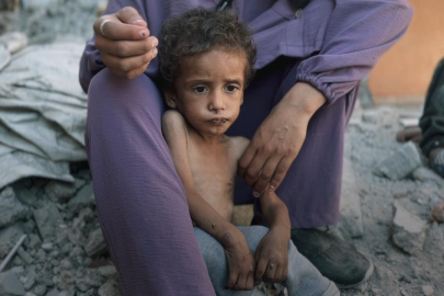 DSÖ: Gazze'de sadece bu yıl yetersiz beslenme nedeniyle 206 kişi öldü