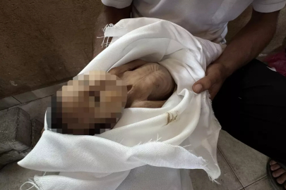 Soykırımcı İsrail'den Gazze'ye kıtlık dayatması! Açlıktan ölenlerin sayısı günbegün artıyor