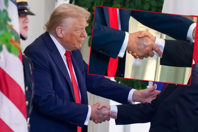 Trump'ın elindeki morluk dikkat çekti... Beyaz Saray'dan açıklama