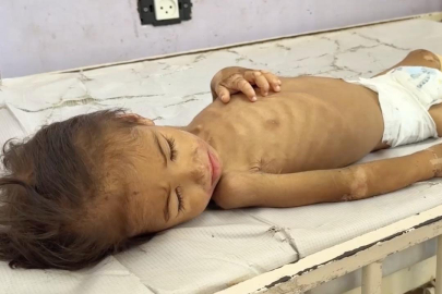 Gazze'de son 24 saatte 1'i çocuk 3 kişi daha açlıktan hayatını kaybetti