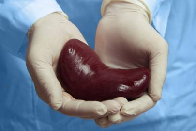 Tıp Dünyasında Devrim: Her Kan Grubuna Uyumlu 'Evrensel Böbrek' Geliştirildi