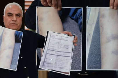 Özel okulda darp skandalı! Soruşturma başlatıldı