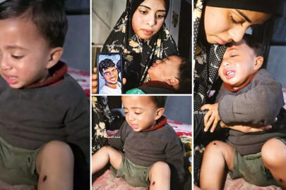 Bacaklarında sigara söndürdüler! 1 yaşındaki bebeğe siyonist işkence