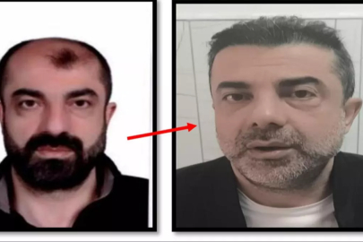 Yüzünü değiştirmesi de yetmedi! 7 yıllık firari ülkeye girer girmez enselendi