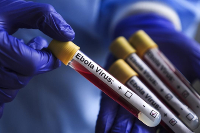 Fransa'da Ebola vakasıyla temas ettiği düşünülen 5 kişi karantinaya alındı