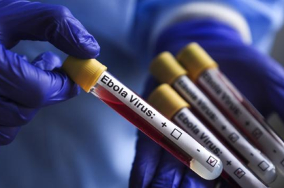 Kongo Demokratik Cumhuriyeti'nde Ebola vakası sayısı 8 bini aştı