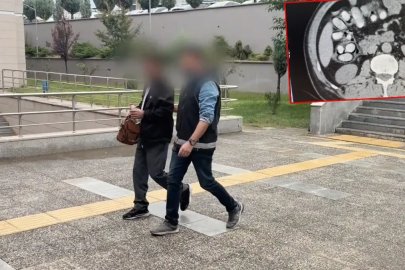 Zehir tacirlerinden pes dedirten yöntem: Midesinden 91 parça çıktı!